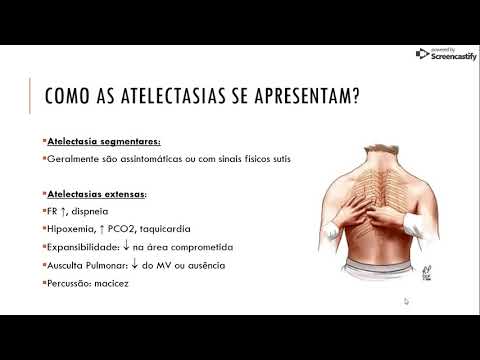 Vídeo: Atelectasia - Descrição, Causas, Sintomas, Prognóstico, Tratamento