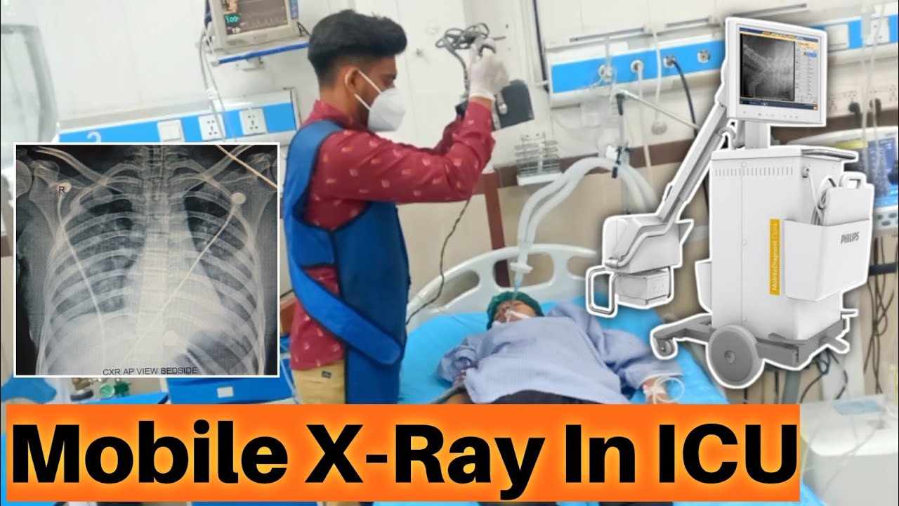 X ray in ICU | portable x ray chest | mobile x ray in faisalabad - YouTube