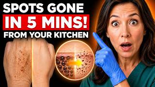 Age Spots Gone! The 1 Kitchen Ingredient Your Dermatologist Will NEVER Mention