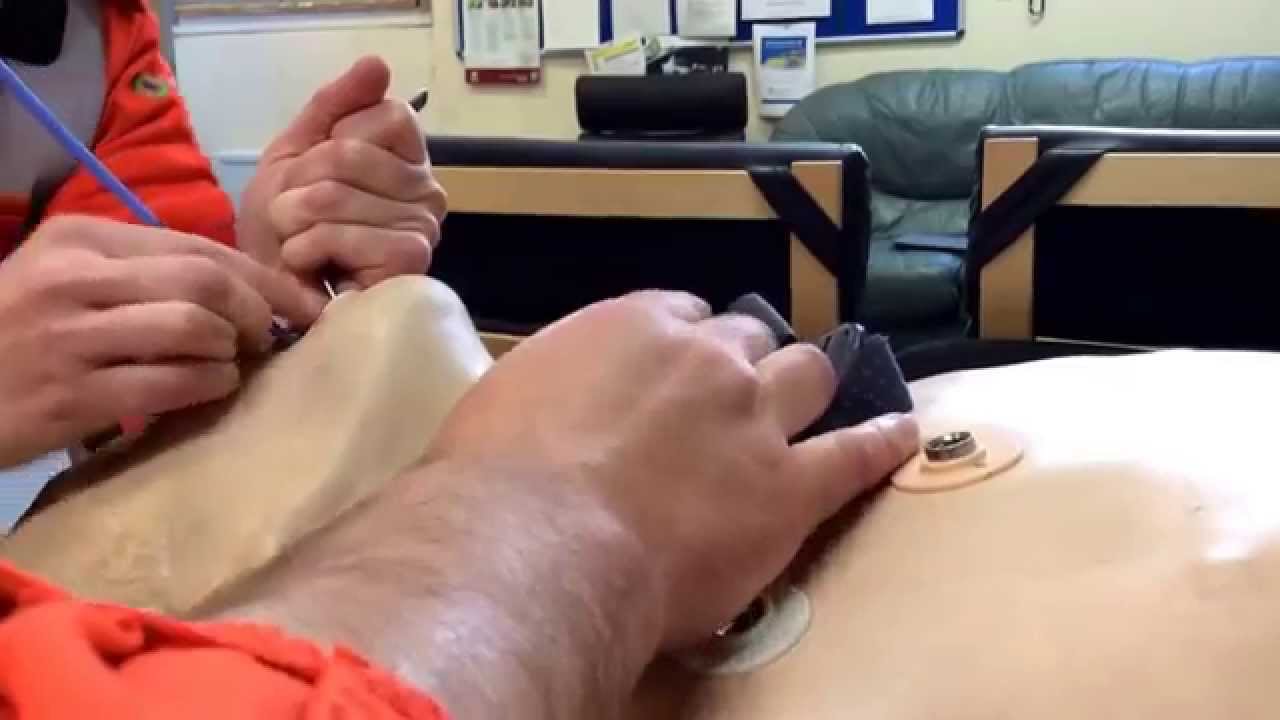 Dessert Spoon Intubation