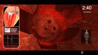 Vs Heartwalker