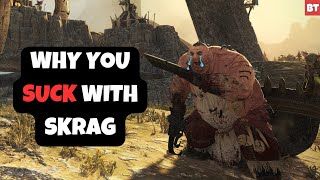 Why You SUCK with Skrag