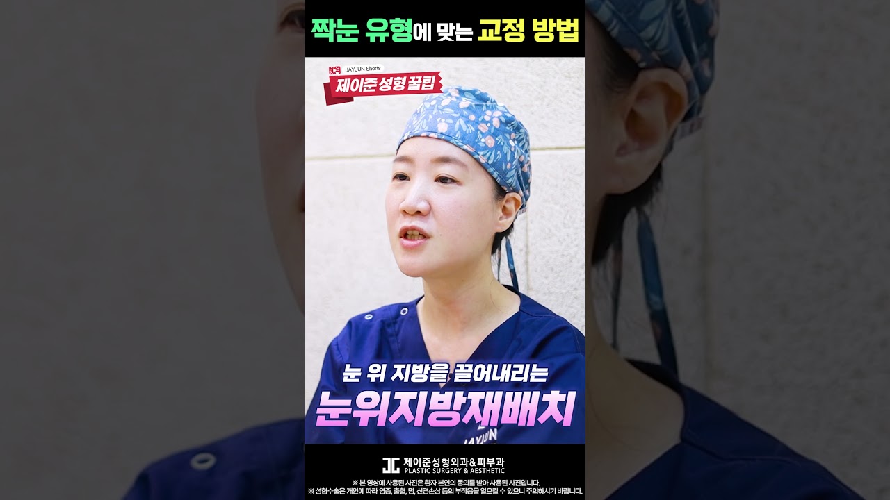 [제이준 성형외과 피부] Cách điều chỉnh mắt lệch phù hợp với mắt tôi là gì? Hình dáng mắt của tôi thuộc loại nào? #shorts #mắtlệch