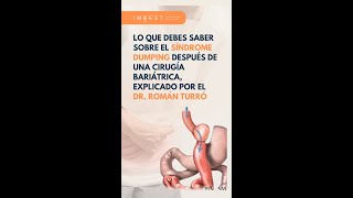 ¿Qué es el síndrome dumping y cómo puede afectar después de una cirugía bariátrica? Dr. Román Turró