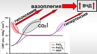 ИВЛ в Нейрореанимации (1 МСН) Горячев А.С.