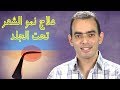 علاج نمو الشعر تحت الجلد 