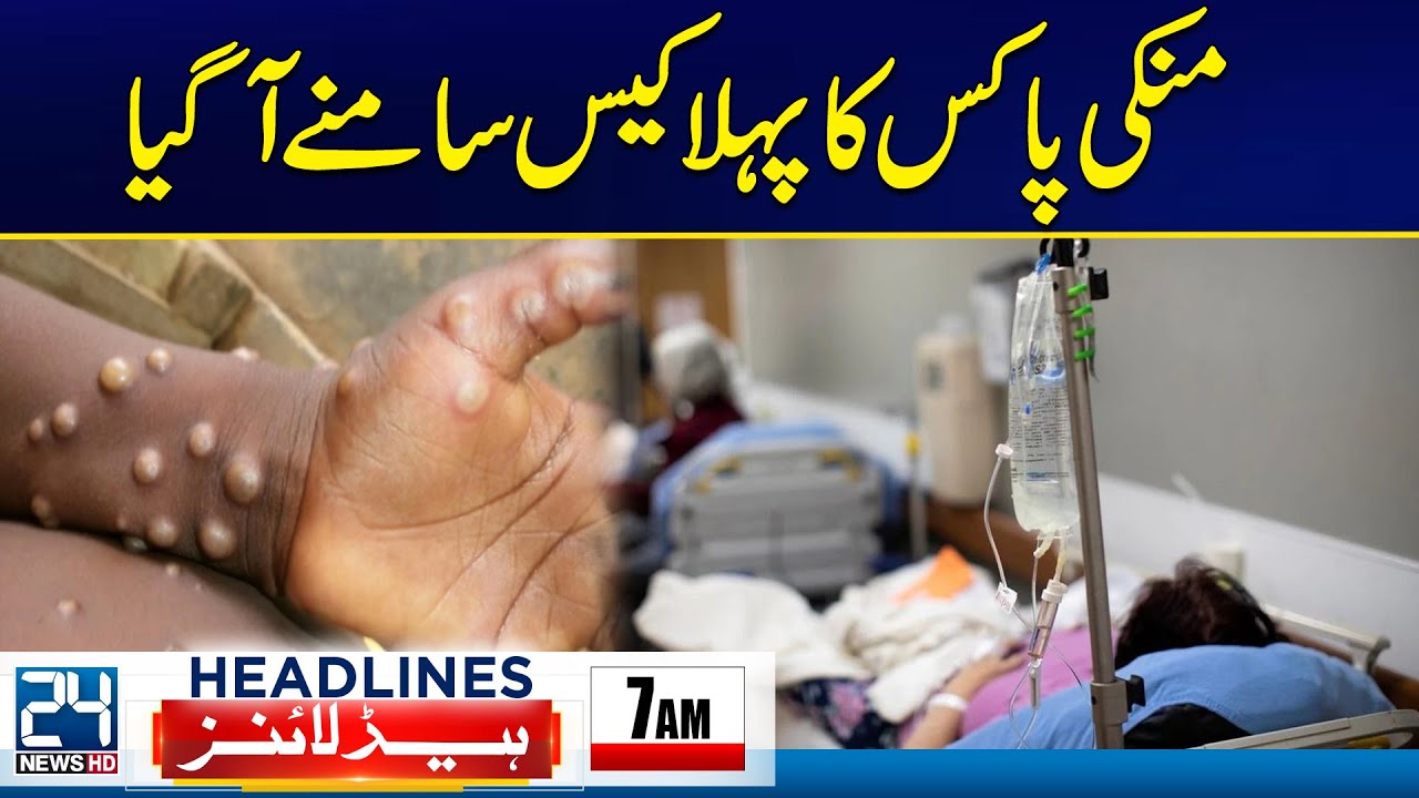 First M-Pox Case Reported in Karachi - Jaffar Express Attack - 7am News ...