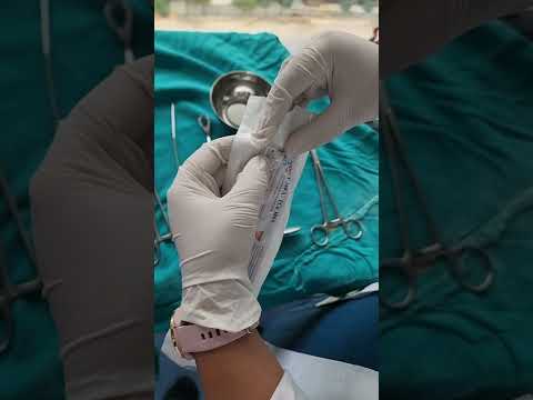 Insertion of an IUD