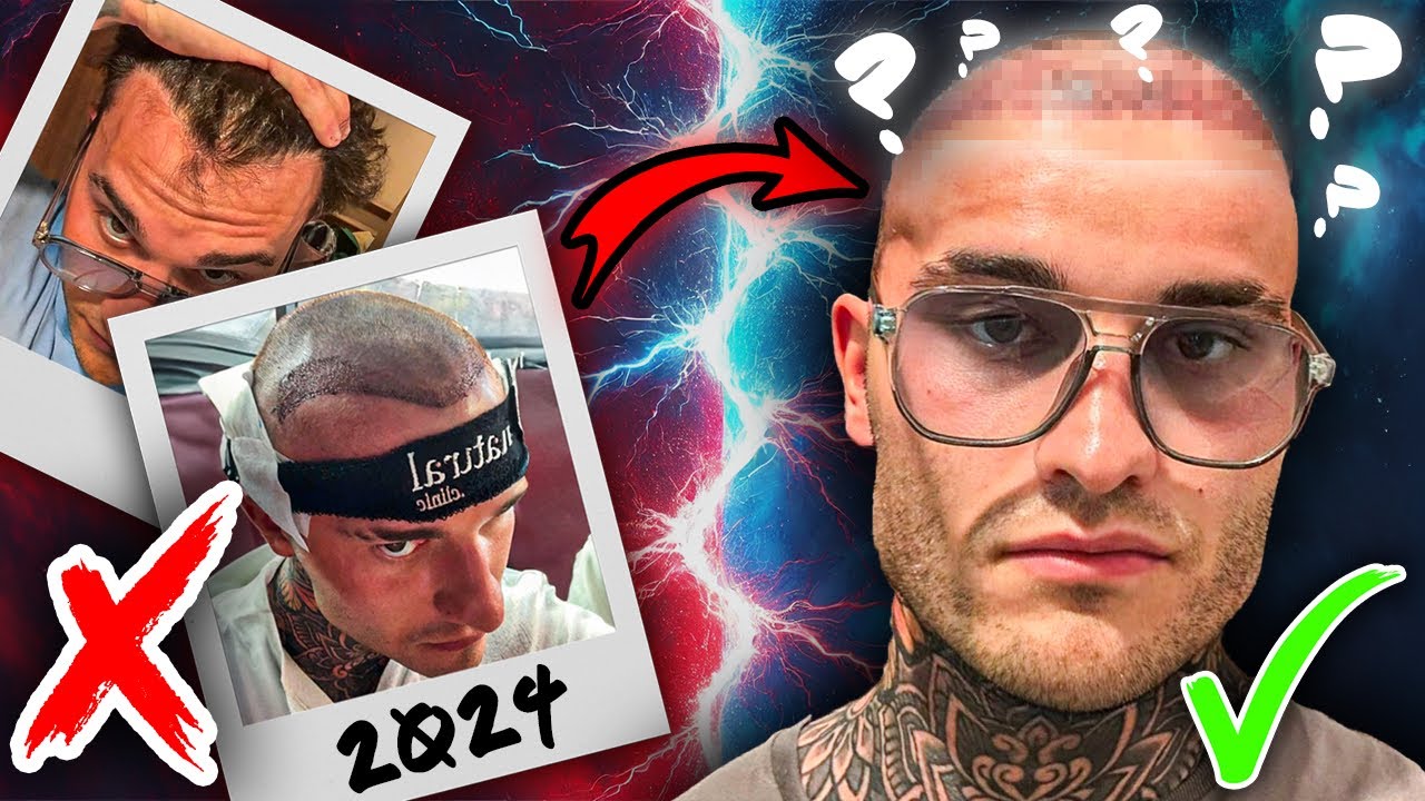 Dal Som Si ZNOVA Nastreliť Vlasy v Turecku?! |NEWHAIR