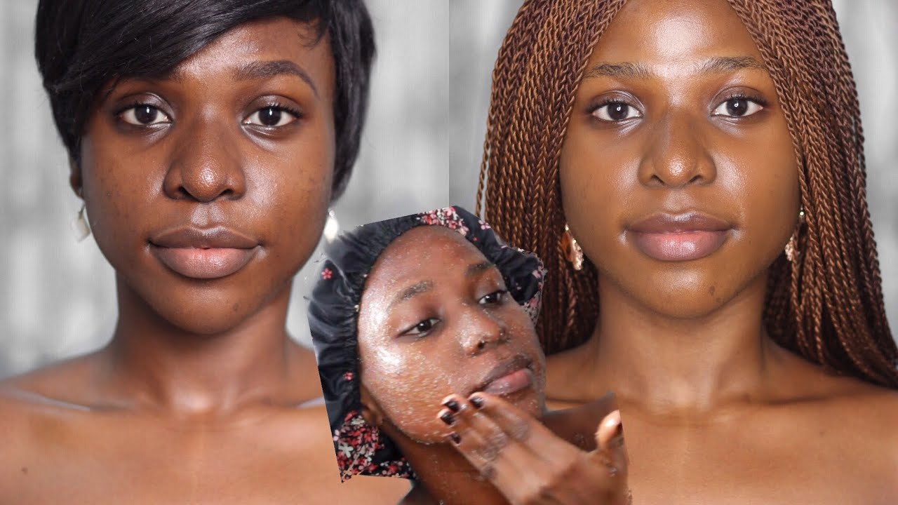 skin bleach for hyperpigmentation