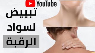 تبييض سواد الرقبة بأسرع الوصفات الطبيعية