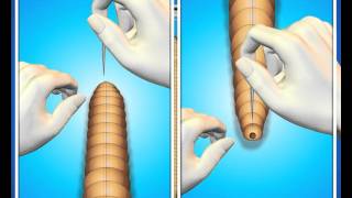 Dissection of Earthworm Digestive System
