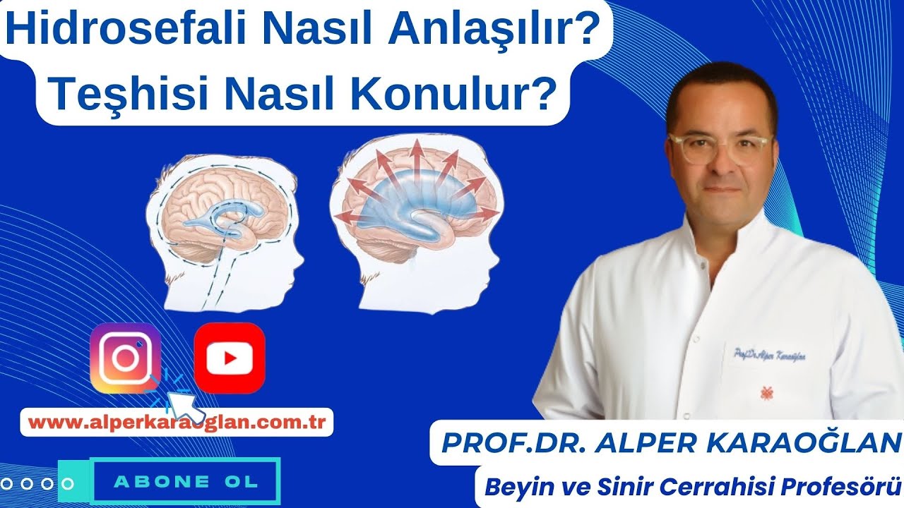 HİDROSEFALİ Nasıl Anlaşılır? Teşhisi Nasıl Konulur? | Prof.Dr. Alper KARAOĞLAN