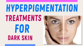 Pigmentation Treatment | झाइयों का इलाज | Dark Spots On Face Treatment | चेहरे के काले दाग़ का इलाज