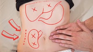 What Your Abdomen Says About Your Health: Abdominal Diagnosis 101