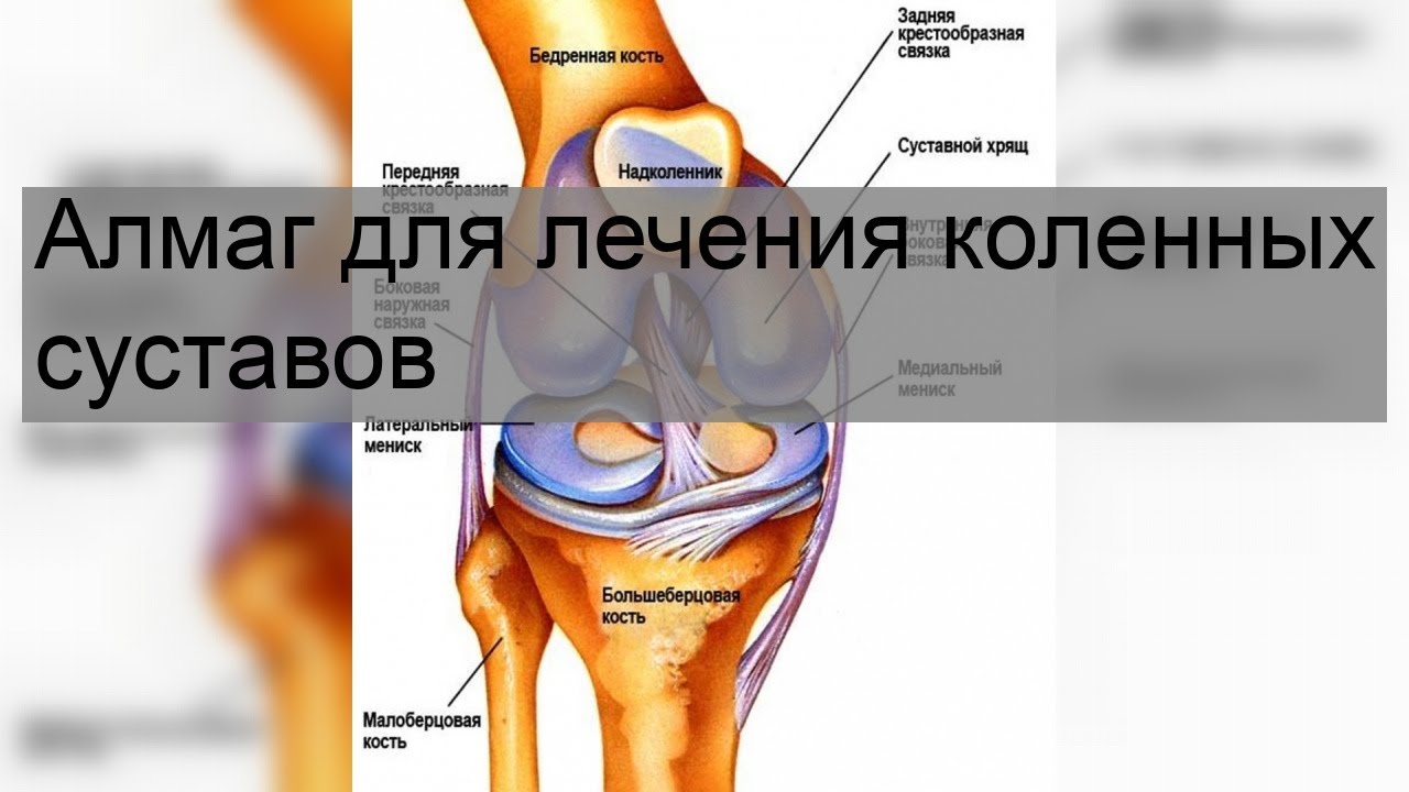 Сильные боли при разгибании колена. Колено болит при сгибании и разгибании. Боль в коленном суставе при сгибании и разгибании причины. Боль в коленном суставе причины. Жидкость в коленном суставе.