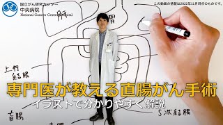 国立がん研究センター東病院方式 腹腔鏡下直腸癌手術徹底