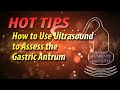 Hot Tip How to Use Ultrasound to Assess the Gastric Antrum GUARD Protocol