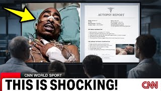 The Autopsy Photos Of Tupac Were Altered — A Forensic Expert Explains Why