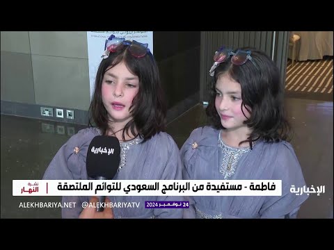 الإخبارية تلتقي بعدد من التوائم السيامية بعد أعوام على فصلهم