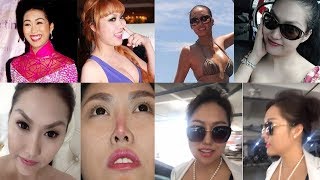 Đây là quá trình 15 lần dao kéo