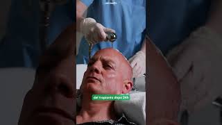 Trapianto di capelli alla Clinica Dermolife: tecniche FUE, DHI e Sapphire FUE