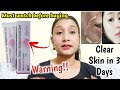 Skin whitening cream|Skinlite Cream| Reduce Darkspot,Pigmentation|Kozicare soap|Clear skin in 3 Days