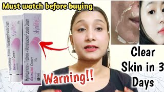 Skin Whitening Creamskinlite Cream Reduce Darkspot,Pigmentationkozicare Soapclear Skin In 3 Days