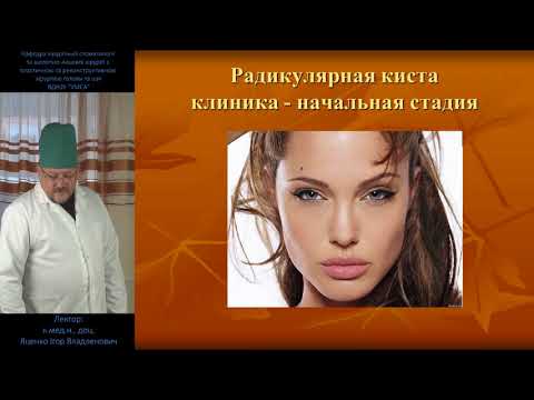 Одонтогенные опухоли и кисты челюстей