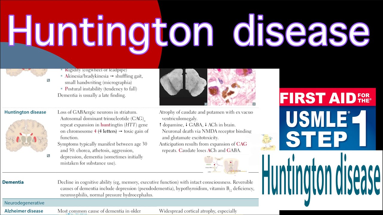 Huntington disease in Hindi/Urdu by first aid for USMLE step 1 - YouTube
