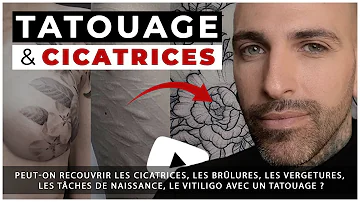 Est-il possible de tatouer sur une cicatrice ?