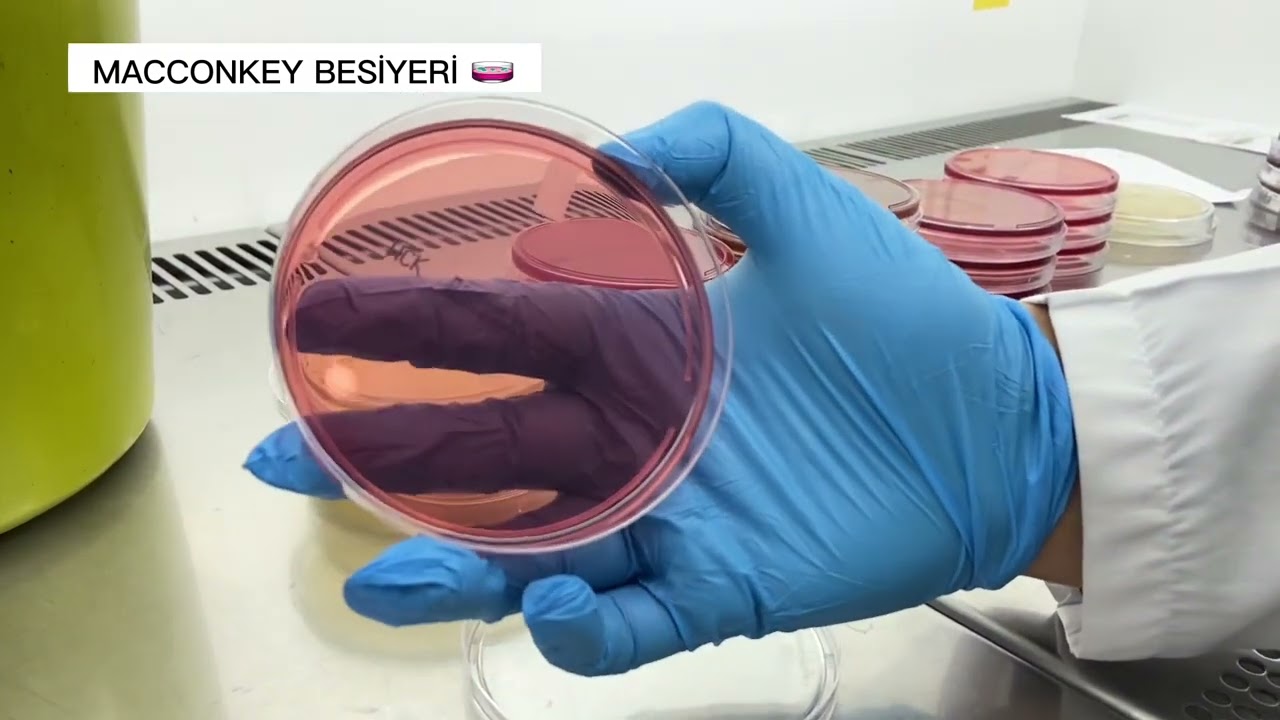 Mikrobiyoloji Laboratuvarı, Besiyeri ve Özellikleri