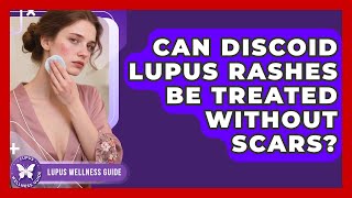 Can Discoid Lupus Rashes Be Treated Without Scars? - Lupus Wellness Guide