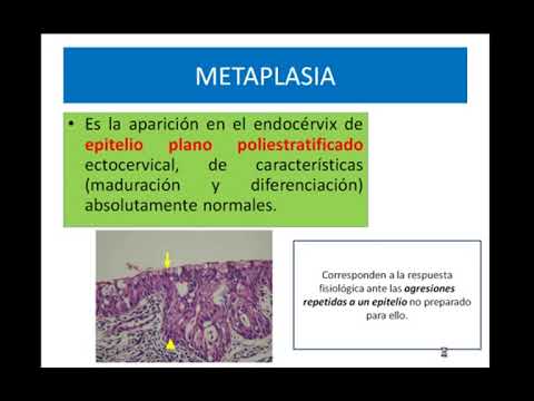 VILLAMEDIC - PATOLOGÍA DE CUELLO UTERINO