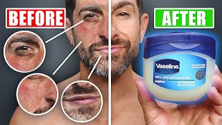 5 Vaseline Hacks to Be MORE Attractive! (WORKS 100%) screenshot 3