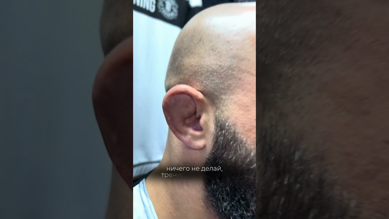 Самая частая травма в борьбе и ММА 