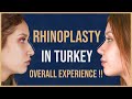 Rhinoplasty in Turkey over all experience | Before and after nose job