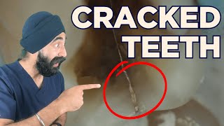 Cracked Teeth Clinical Guidelines - Chase? Fibers? WHEN to Intervene - PDP246