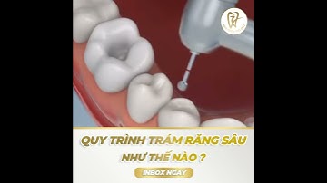 Quy trình hàn trám răng sâu diễn ra như thế nào?
