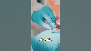 Cách Chỉnh Sai Khớp Cắn Hiệu Quả Nhất | Niềng Răng, Phẫu Thuật Hàm, Bọc Sứ!