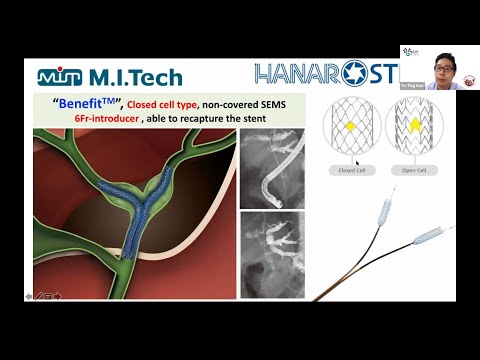 What to know for hilar stentting - Dr. Yu-Ting Kuo(National Taiwan University Hospital)