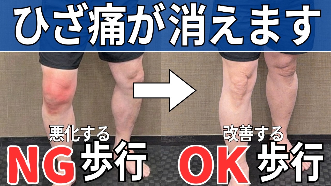 【やってはいけない】悪い歩き方・良い歩き方  |  大阪市都島区 さかとう整骨院