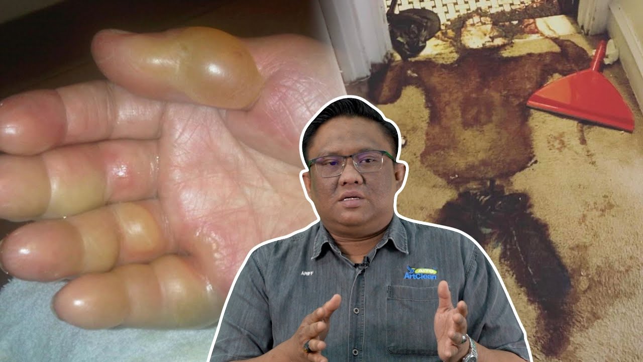 Bau Busuk Mayat Datang daripada Cecair Ini