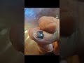 Smashed thumbnail/nail loss time lapse