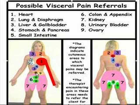 Visceral Referral Patterns Chart