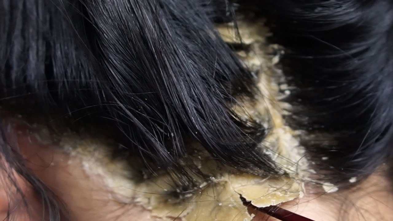 Ultimate Relaxation with Comb 