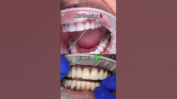 The Absolute BEST Way To Floss Your Teeth! 🦷🪥