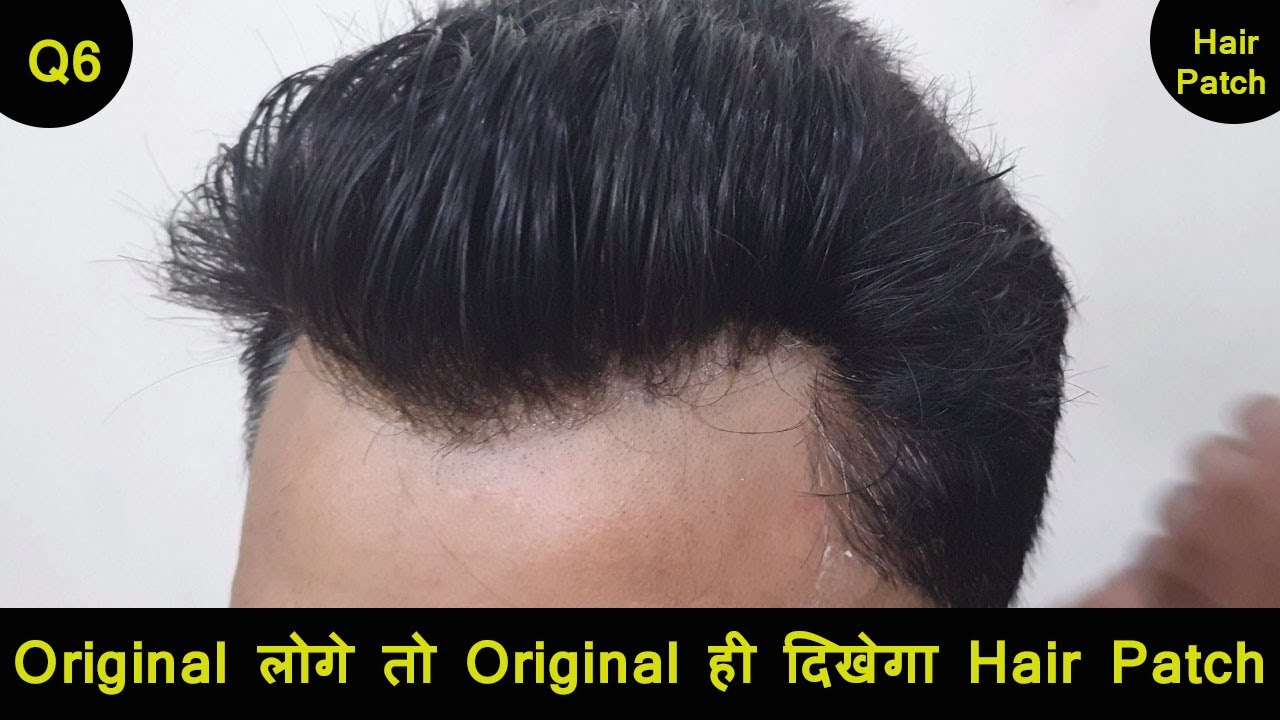 Best Hair Patches for Men | Hair Transformation | Full Lace Hair Wigs for  Men Natural Frontline - YouTube