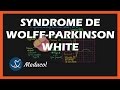 Wolff parkinson white syndrome wpw ecg symptmes et traitement