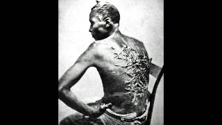 Paid In Scars? (2nd Corinthians 11:23-28) James Flanders